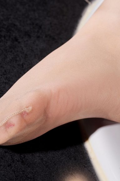 Yabo亚博官方网站_在广州隆胸,王世虎、李明、王洪勇、闫爱跃、李高峰谁更厉害(图4) yabo官网